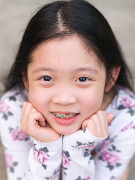 early orthodontic treatment